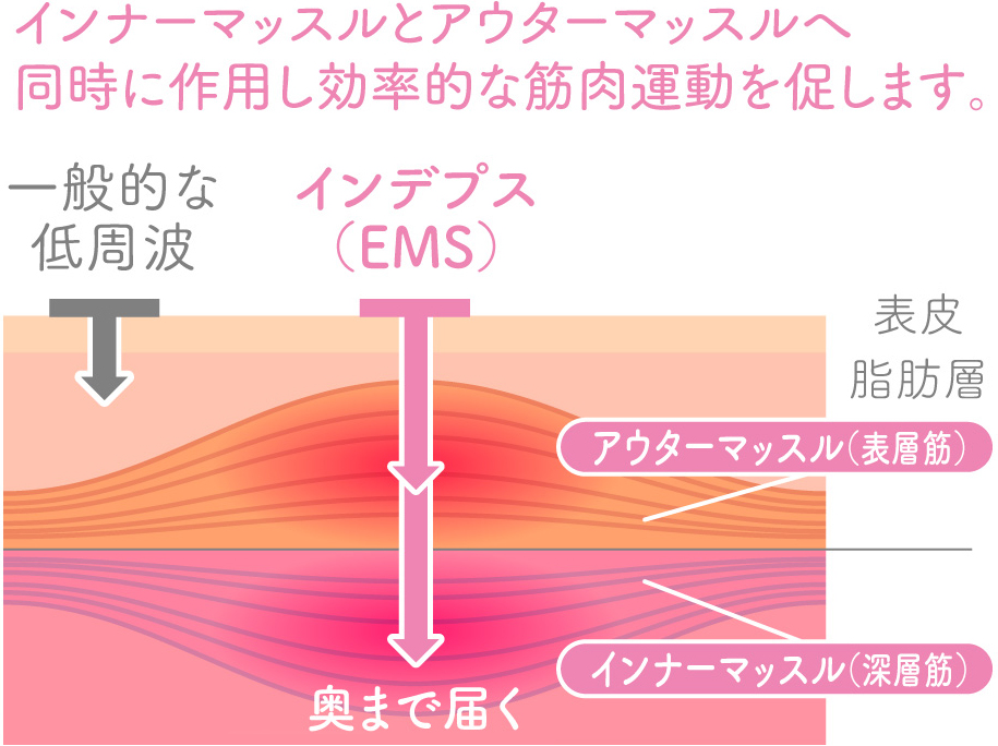 EMS利用の特徴